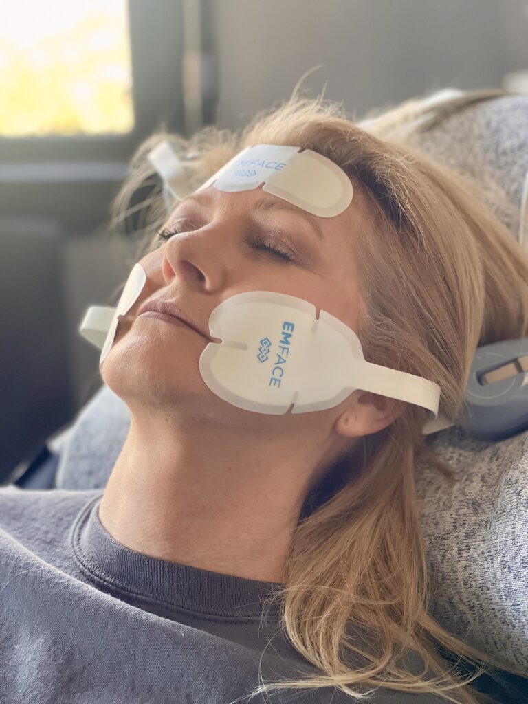 EMFACE®: NON-SURGICAL FACIAL REJUVENATION 1 IMG 2707
